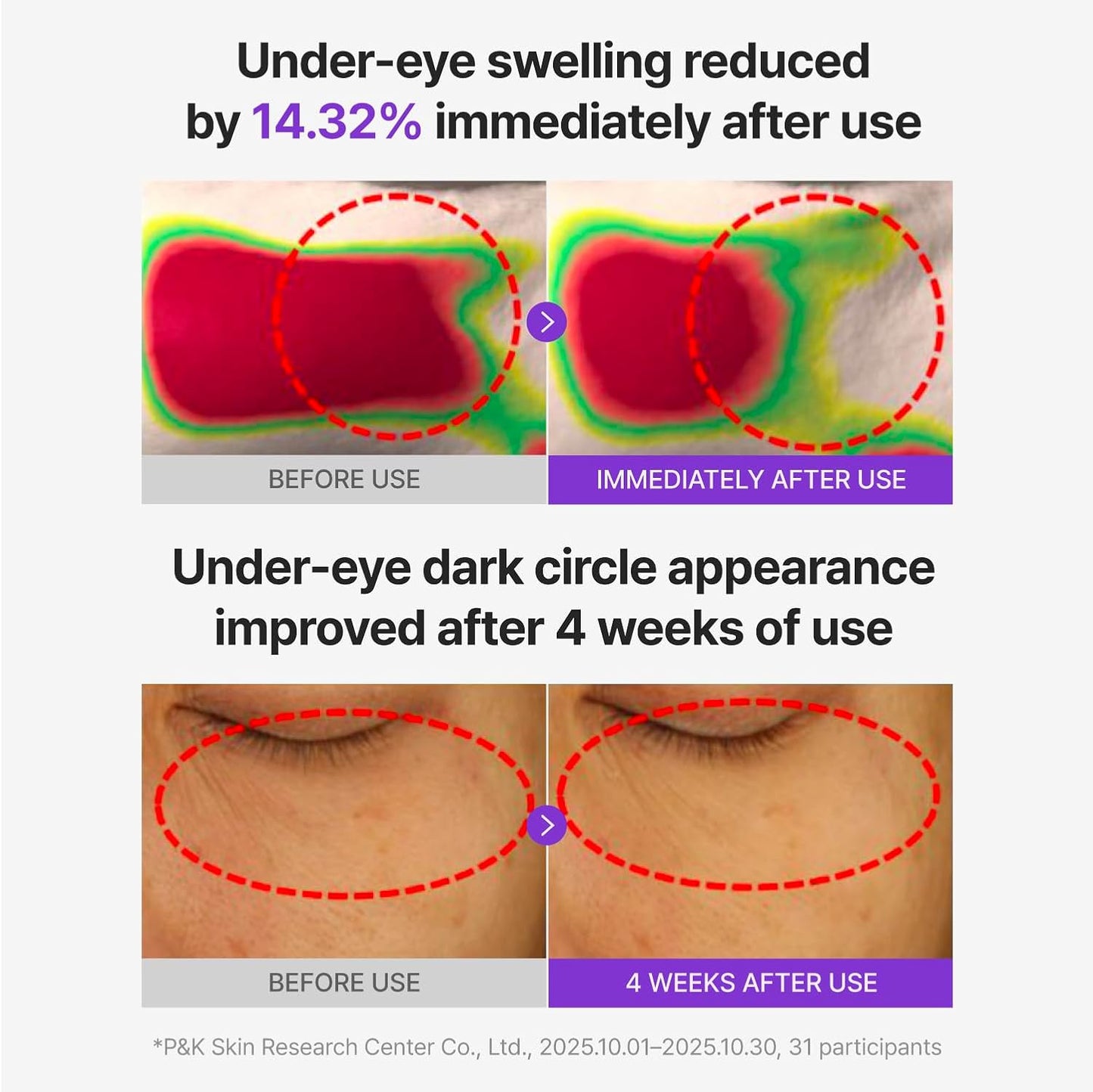 Centellian 24 360º Shot PDRN Glowing Eye Patch (6 pcs)